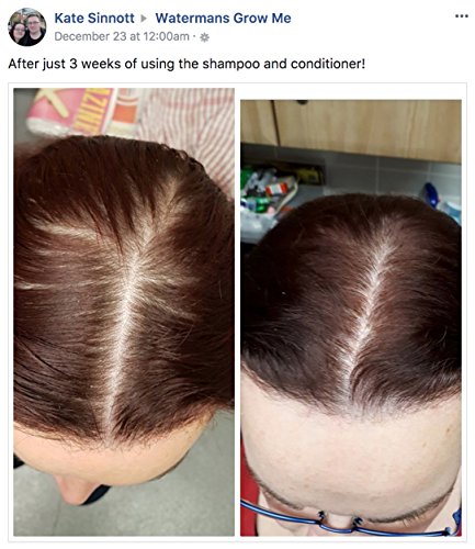Best Hair Growth Shampoo Sulfate Freie, Coffein, Biotin, Argan oil, Allantoin, Rosemary. Stimuliert das Nachwachsen der Haare, Hilft Stop Haarausfall, Haar wachsen schnell, Haarausfall Behandlung für Männer & Frauen - 3
