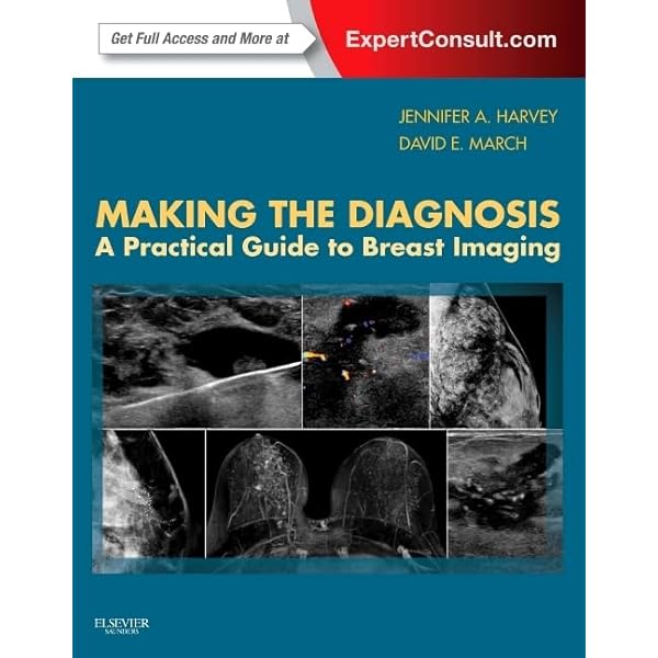 健康・医学 Breast Ultrasound A. Thomas Stavros Breast Ultrasound: Stavros MD FACR, A. Thomas: 9780397516247