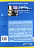 Image de Tomografía Computarizada Multicorte en Patología Musculoesquelética: Guía para la práctica diaria
