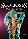 Image de Scolioses : oui, ça se guérit (sans corset)