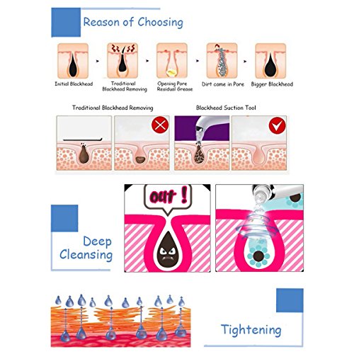 LuckyFine, Mikrokristalline Absorption schwarz Kopf Massagegerät Vakuum Saug Microdermabrasion Gerät Loch Reinigung Schönheit Maschine Rose - 7