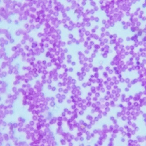 Blips Ultra Labkit - Kit da tavolo per trasformare lo smartphone in microscopio