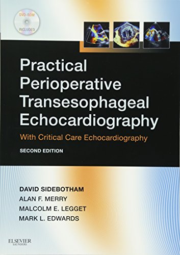 Practical Perioperative Transesophageal Echocardiography: Text with DVD-ROM, 2e Practical Perioperative Transesophageal Echocardiography: Text with DVD-ROM, 2e