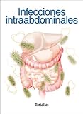 Image de Miniatlas Infecciones intraabdominales