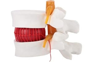 Joyzan Modèle de Vertèbres, Hernie Discale Lombaire Humain 1: 1,5 Humaine Colonne Vertébrale Étude Anatomique Démonstration Affichage Outil Pédagogique Médicale Dégénérative D'anatomie Présentation