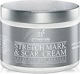 Art Naturals Stretch Mark & Scar Removal Cream 120ml - Best Body Moisturizer to Remove, Decrease & Prevent New / Old Stretch Marks & Scars - Made in USA with Organic Ingredients - Use After Pregnancy