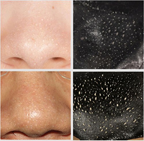 Preisvergleich Produktbild ESAILQ 5pcs entfernen Sie Qualitäts-Mineralschlamm-Nasen-Schwa...