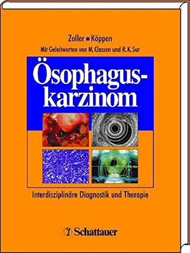 Preisvergleich Produktbild Ösophaguskarzinom: Interdisziplinäre Diagnostik und Therapie