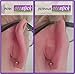 Otostick - TWIN PACK - Instant Correction for Prominent Ears