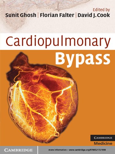 Cardiopulmonary Bypass (Cambridge Clinical Guides) (English Edition) Cardiopulmonary Bypass (Cambridge Clinical Guides) (English Edition)