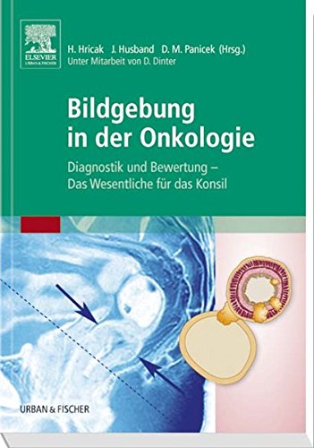 Bildgebung in der Onkologie: Diagnostik und Bewertung - Das Wesentliche für das Konsil