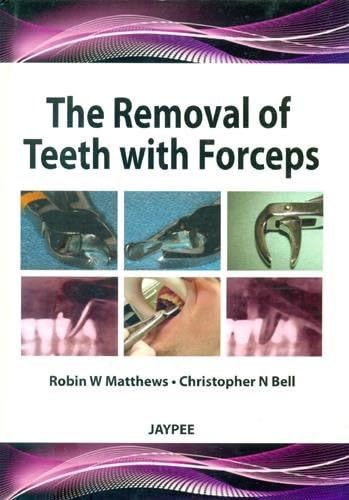 The Removal of Teeth with Forceps