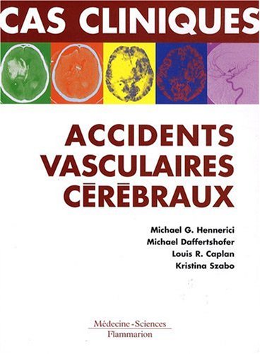 Download Cas cliniques : accidents vasculaires cérébraux : Formes cliniques habituelles et inhabituelles Download Cas cliniques : accidents vasculaires cérébraux : Formes cliniques habituelles et inhabituelles