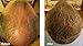 Dark Brown Hair Building Fibers Large 22g Pack Amazing New Concept to Save Money, Fibres For use by Men and Women