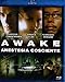 Awake - Anestesia Cosciente