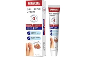 AECECI Mycose Ongles Des Pieds Crème 20g