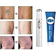 Blue Light Therapy Varicose Veins Pen/Cream - Soft Scar Removal Set. (Blue Treatment Pen + Varicose Vein Cream)