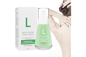 Fengyang® Body Acne Serum, Peeling-Akne-Serum, Akne-Creme für den Körper, Body Akne-Serum, Acne Repair Cream, zur Entfernung von Akne, Pickeln und Acanthosis Nigricans