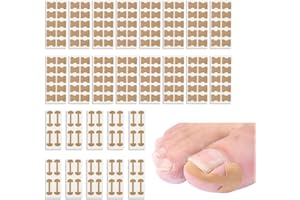 KEQAR 200 pezzi correttore per unghie incarnite, Unghia Incarnita Alluce, Unghie Incarnite Piedi, Cerotti per Unghie