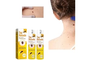 CHISHAYA Tag Recede Bienengift-Behandlungsspray, Bienengift Spray zur Entfernung von Hautflecken, Tag Recede Bee Venom Spray für Alle Hauttypen 20ml