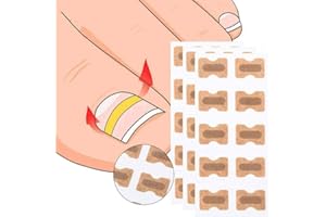 R & R ENTERPRISES 5 Set Glue Free Toenail Patch - Ingrown Toenail Tools Kit Premium Nail Treatment Foot Tool,Ingrown Toenail Removal Correction Patch Professional Pedicure Tools Keep Nails Healthy & Relieve