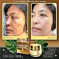 Gold 24k Whitening Anti-Melasma Facial Cream with anti- melasma soap 15g