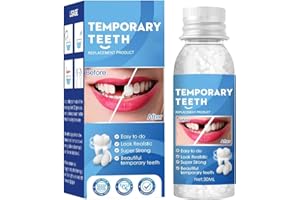 LOMEYA Fix Broken or Missing Teeth with a Temporary Filling Repair Kit - Bridges Gaps and Replaces Chipped Teeth with False Teeth and Fillers