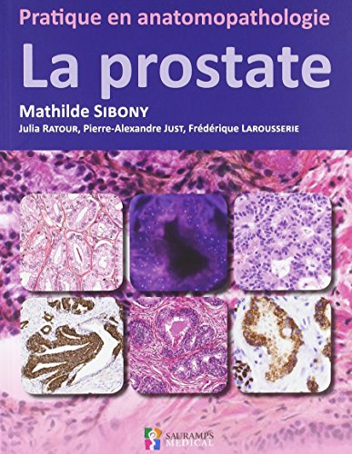 Download La prostate Download La prostate