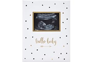 Pearhead First 5 Years Baby Memory Book with Sonogram Photo Insert, Black and Gold Polka Dot, Baby Keepsake Memory Book, Hello Baby Babybook