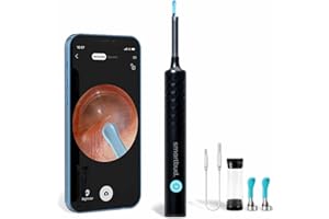 Smartbud Ear Wax Removal Tool with Camera - 1920P Smart Ear Cleaner Earwax Removal Kit - Otoscope with Light (6 LED Lights) Best Ear Camera Ear Scope Endoscope Ear Cleaning Kit Ear Cleaning Camera