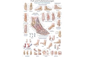 Erler Zimmer anatomische Lehrtafel, Fuß und Fußerkrankungen, Lehrmittel, 50x70cm