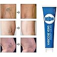 Blue Light Therapy Varicose Veins Pen/Cream - Soft Scar Removal Set. (Varicose Vein Cream)