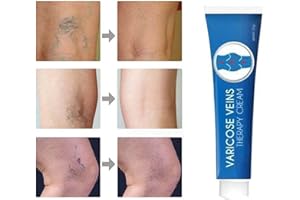 NIBLIDO Blue Light Therapy Varicose Veins Pen/Cream - Soft Scar Removal Set. (Varicose Vein Cream)