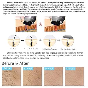 Carejoy Most National Magic SHOWLISS PRO Blu-ray Thermal Hair Removal Device Permanent Hair Removal - Image 7