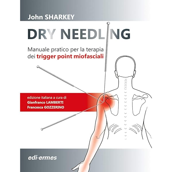 Ago Per Agopuntura In Acciaio Siliconato Con Manico In Argento Con Testina E Guida (Azimut - Foto 2