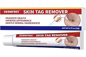 NAAONI Warzenentfernungscreme 20 Gramm, Skin Tag Remover, geeignet zur Warzenentfernung, bei gewöhnlichen Warzen und flachen Warzen an Hand- und Fußsohlen