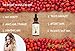 BeYouthful Rosehip Oil - 100% Pure Organic Cold Pressed Seed Oil Nourishes Skin, Hair And Nails - Potent Antioxidant Moisturiser For Fine Lines, Age Spots, Wrinkles On Face And Scars, Stretch Marks On Body