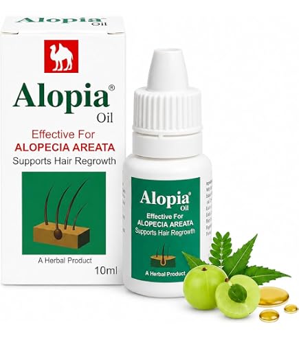 Alopecia Amazing Hair Growth by Alopecia : Amazon.co.uk: Beauty
