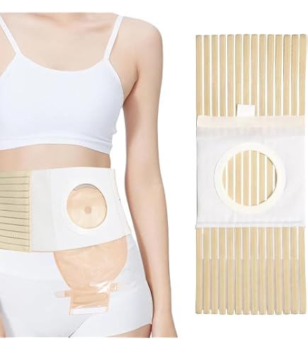 Fascia per Stomia per Uomini e Donne, Cintura per Colostomia Fascia Ernia Ombelicale, Design per Stomia a Forma di U, per La Cura Postoperatoria di Colostomia e Sacca per Uretrostomia(L