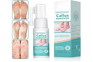 ANSHKA Professional Callus Remover Extra Strength Spray, Foot Callus Removal Spray, Foot Peeling Spray for Remove Dead Skin and Calluses on Feet (1pcs)