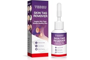 TESEU Wart Remover, Wart Removal, Verruca Remover, Fast Effective Skin Tag Removal for Common Warts, Plantar Warts, Corn and Calluse, Suitable for All Skin Types