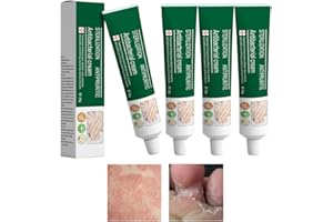 HAWEWE Crème Antifongique à Base De Plantes Pour Les Mains Et Les Pieds, Crème à Base De Plantes Pour éliminer Les Champignons Des Pieds, Crème Pour Les Champignons Des Ongles Des Pieds (4Pcs)