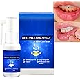 KASTWAVE Mouth Ulcer and Canker Sore Relief Spray for Fresh Breath and Dry Mouth, Provides Pain Relief, Promotes Healing, Oral Ulcer and Breath Sprays with Ingredients