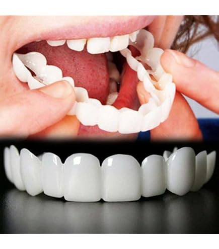 Lot De 6 Boîtes De Fausses Dents Instantanées - Placages à Encliqueter - Neuf