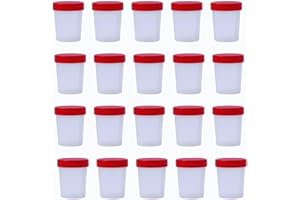 EASYGADGET 20 Botes Estériles de Plastico para Análisis de 60ml. Vasos con Tapa Desechables para Test de Liquido, Orina, Pruebas y Muestras de Heces, o Líquidos Biológicos.