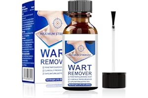 NANQUAN Verruche Rimozione,Effetto Sicuro Della Pelle Tag Remover Verruca Liquido Trattamento,Formula Potente con Acido Salicilico,Adatto Alla Maggior Parte Delle Verruche del Corpo,30ml