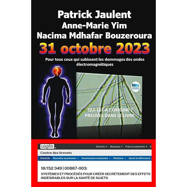 Sigilli In Silicone Per Birra - 25 Pezzi, Rosso, Per Home Brewing E Bottiglie GROLSCH - Foto 10