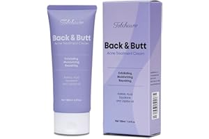 Tobcharm Akne Creme für den Rücken, Anti Pickel Creme am Gesäß, Behandlung von Akne am Körper mit Azelainsäure 100 ml, Acne Creme Behandlung von Pickel, Creme gegen Pickel, Rücken-Akne-Behandlung