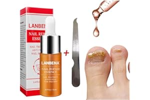Beito 1PC Nail Riparazioni Soluzione per il rinnovo delle unghie di oli essenziali uccide il fungo protegge dal decolorazione Trattamento dei funghi del chiodo per unghie fragili e screpolate (12ML)