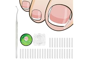 50 st nagelklippar, set för korrigering av inväxta tånaglar, tånagelkorrigering, smärtfri tånagelslipningsremsor med tånagellyft, verktygsset för inväxta tånaglar